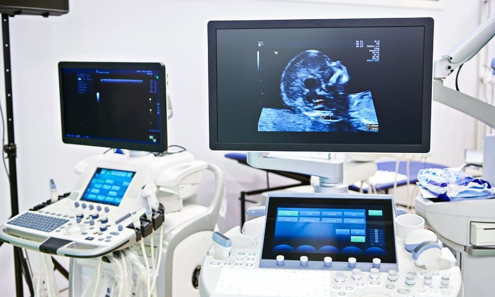 baby ultrasound machine